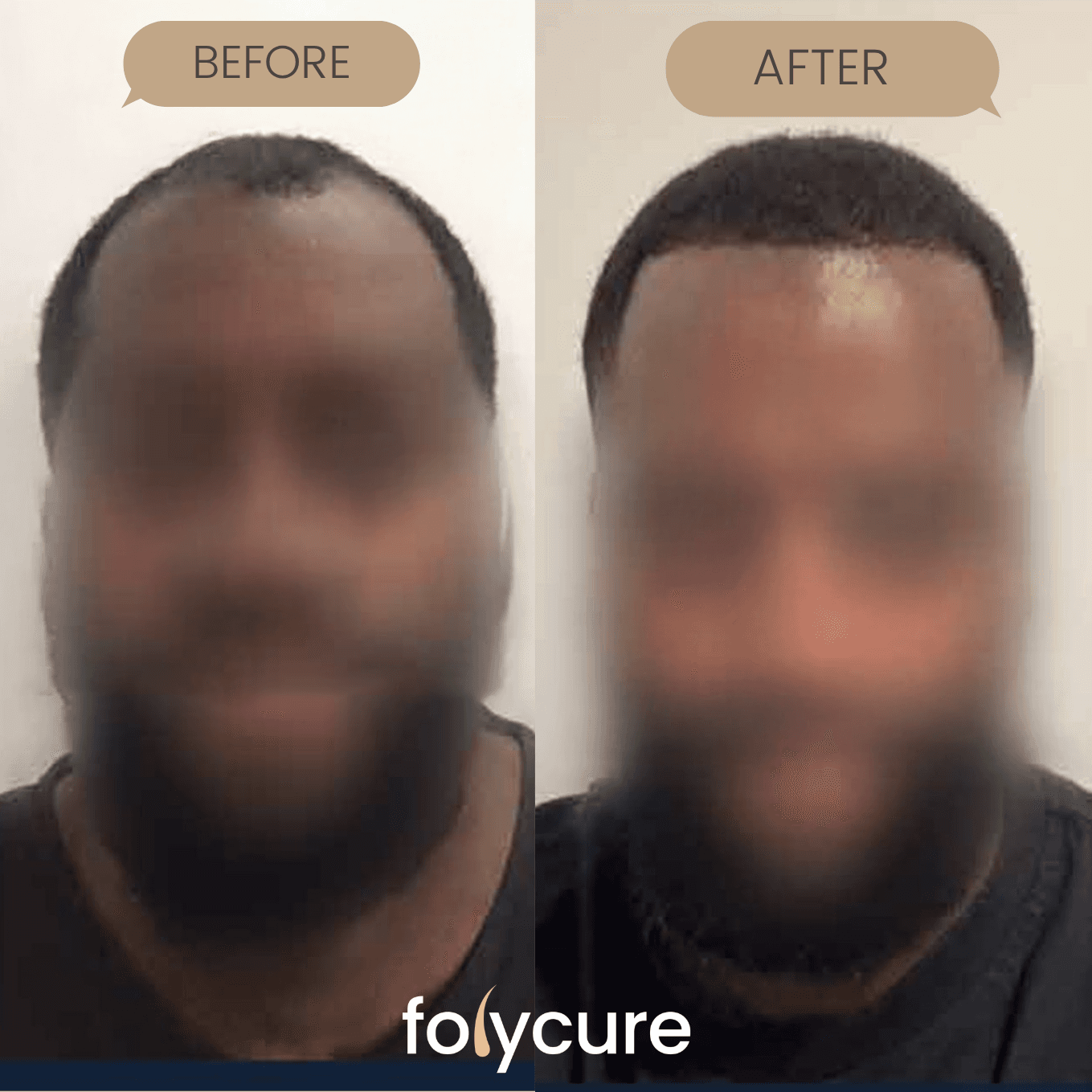 Before and after example