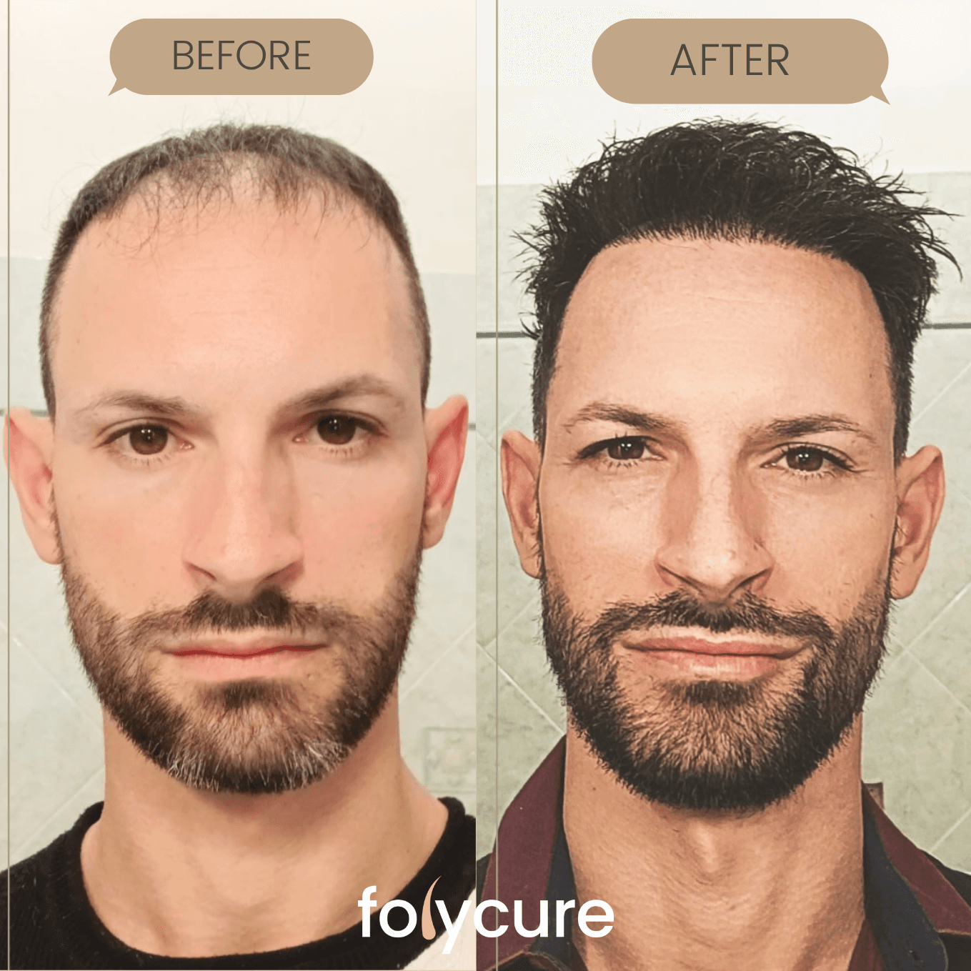 Before and after example