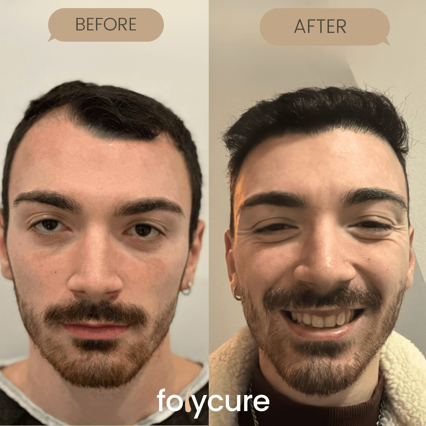 Before and after example