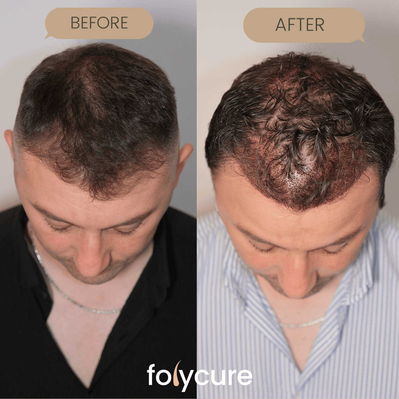 Before and after example