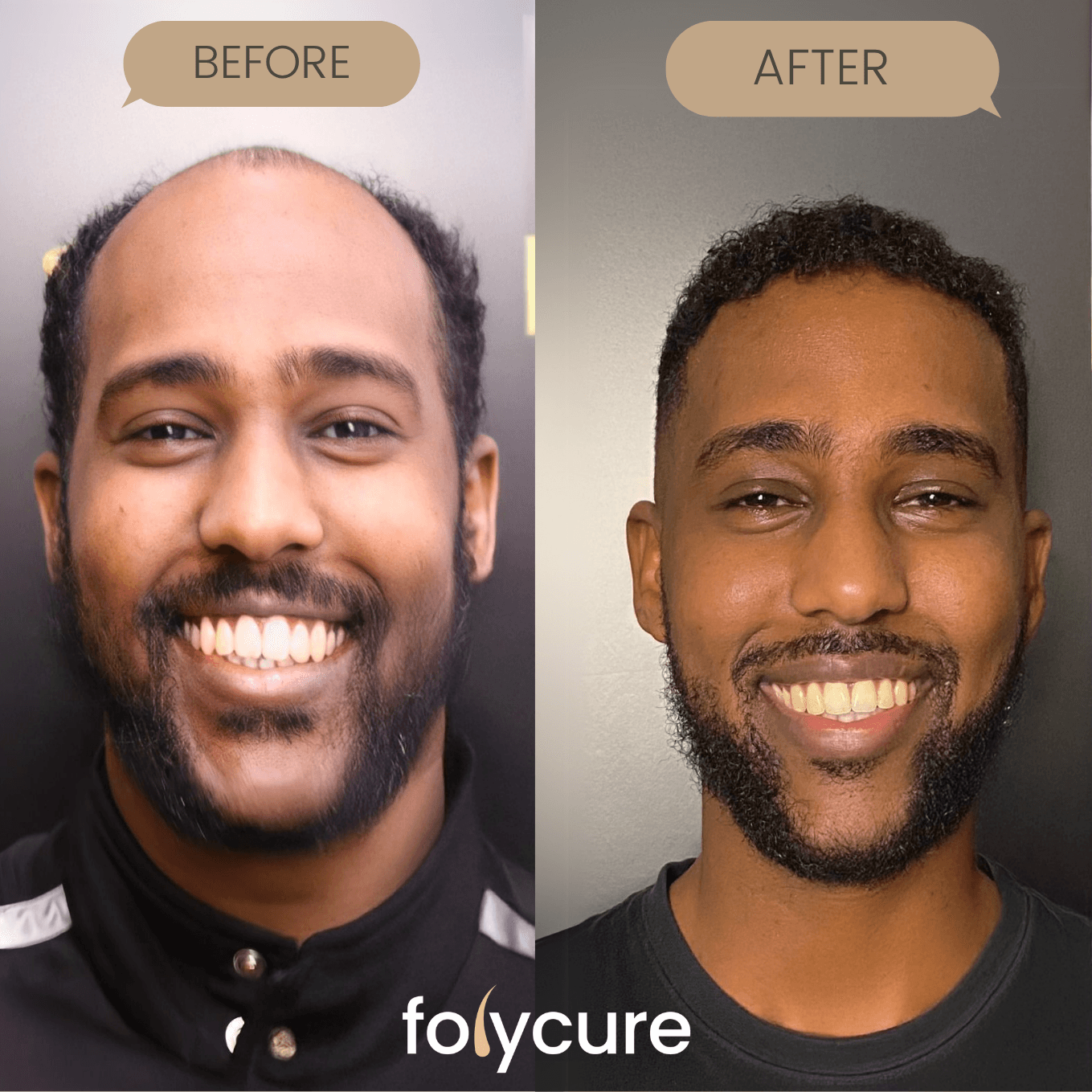 Before and after example