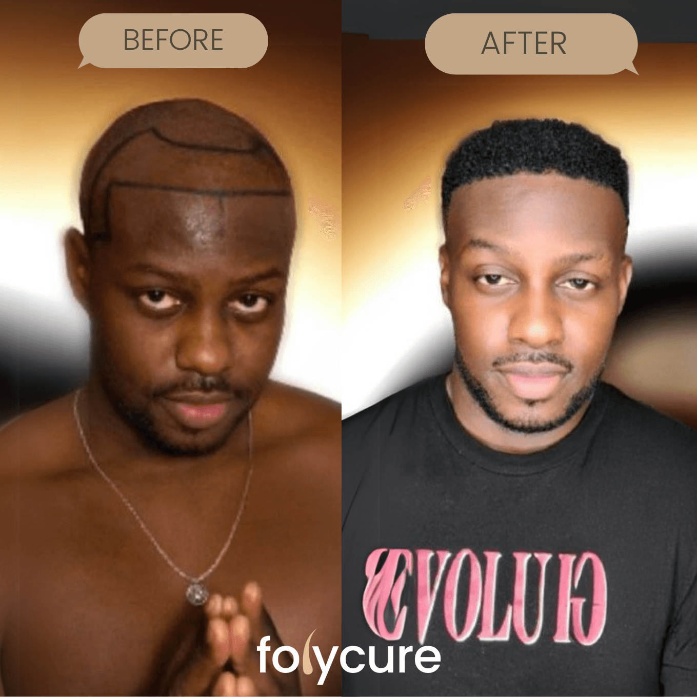 Before and after example