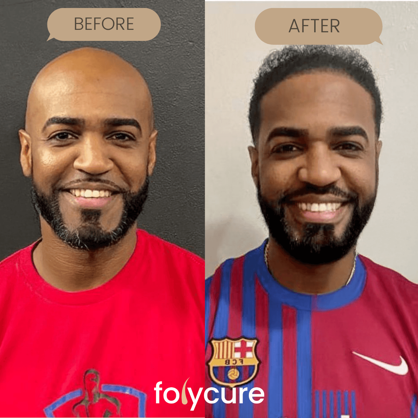 Before and after example